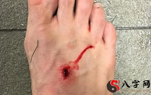 梦见自己脚流血